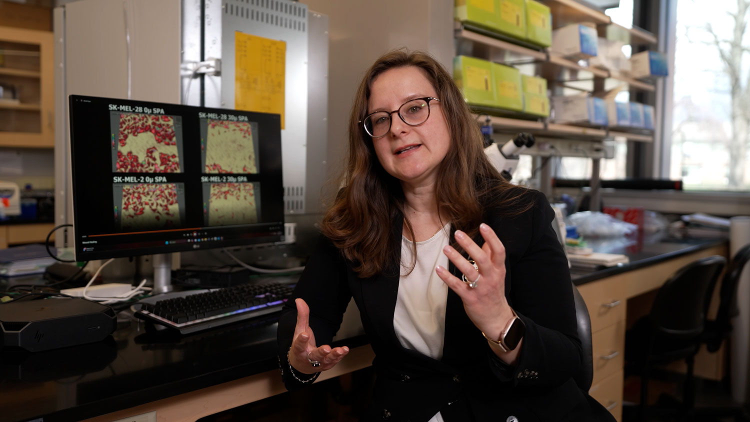 A woman with long brown hair and glasses sits at a laboratory workstation, gesturing with both hands as she speaks. She wears a black blazer over a white blouse, and a computer monitor beside her displays four microscopy images with red and pale green patterns.